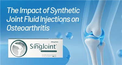 Dampak Suntikan Cairan Sendi Sintetis terhadap Osteoartritis